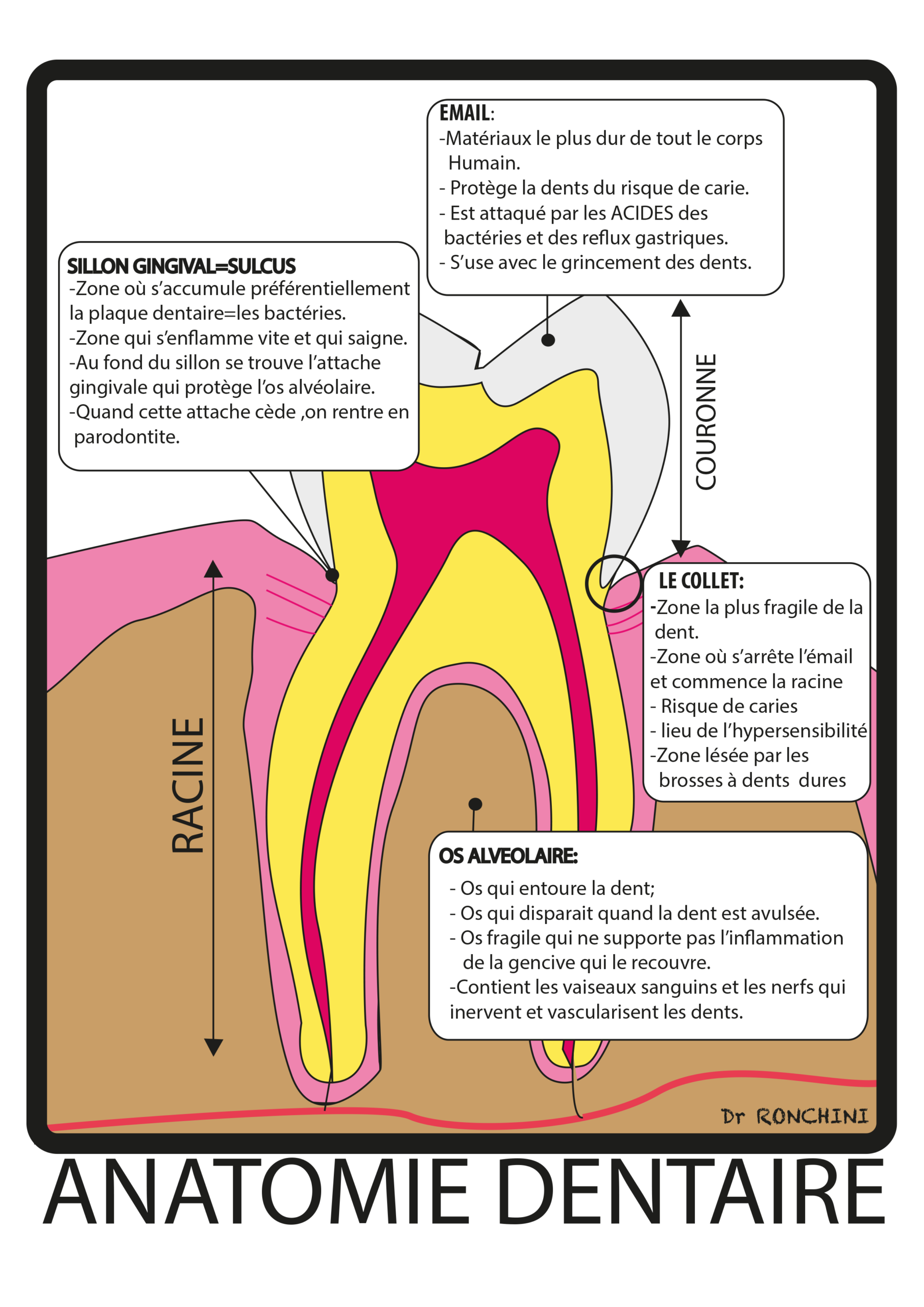 Schéma explicatif de la parodontie par le Dr Ronchini Catherine, chirurgien dentiste sur Carbonne au sud Toulouse, Spécialisée dans la parodontie et la Méthode Bonner.